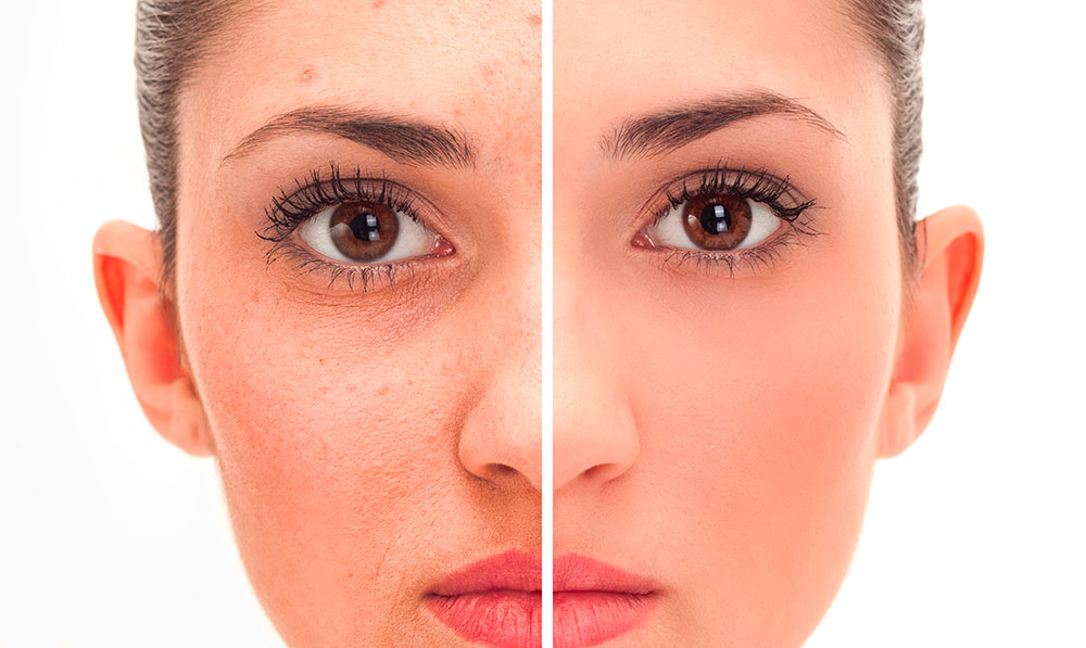Face Editor: Powerful Online Tool for Stunning Photo Makeovers