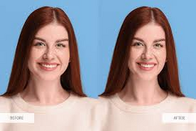 Best Facial Slimming App – Achieve a Naturally Skinny Face Without Surgery